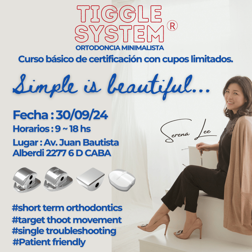 Curso tiggle system